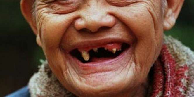 Nenek Renta Dibegal, Harta Dikuras, 2 Gigi Emas Dicabut Paksa