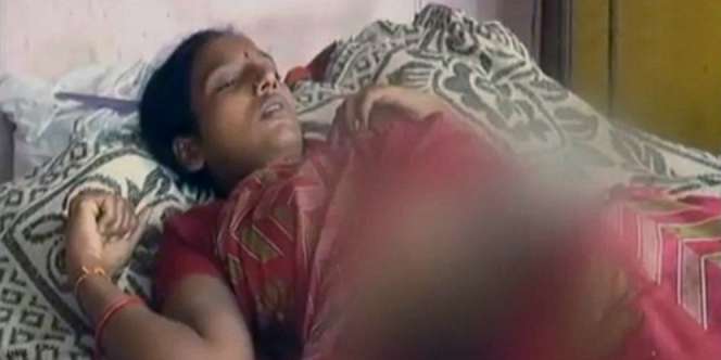 Hamil Bayi Perempuan, Mertua Siram Air Keras Perut Menantu