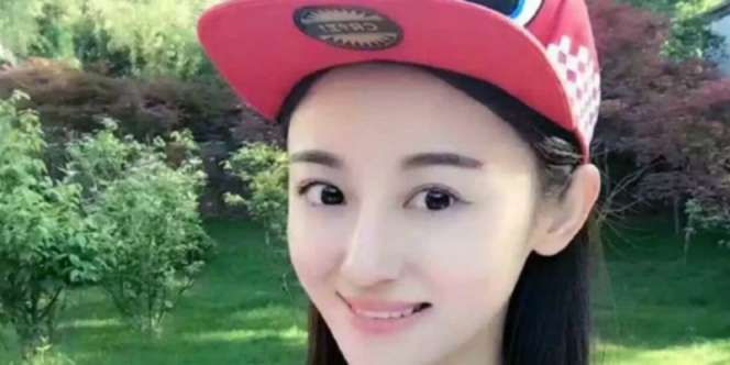 Innalillahi... Artis Cantik Tewas Setelah Bekam