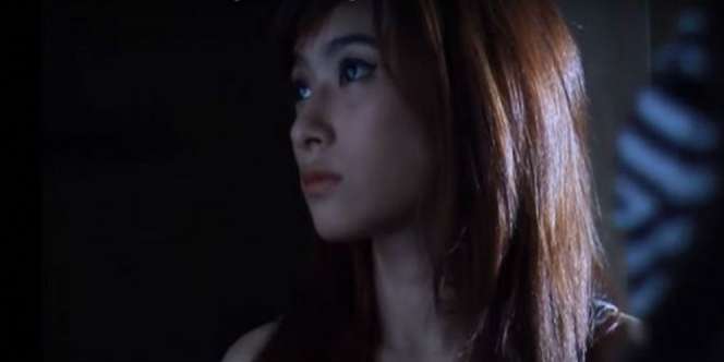 Operasi Plastik Gagal, Wajah Model Cantik Berubah Mengerikan!