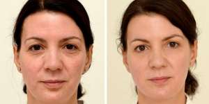 Fakta Menopause yang Wajib Diketahui Wanita