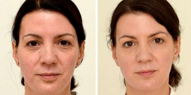 Fakta Menopause yang Wajib Diketahui Wanita