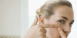 Remaja Berjerawat Jadi Awet Muda Saat Tua, Benarkah?