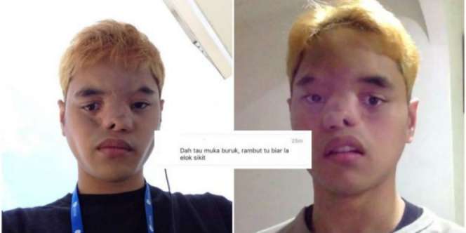 Luapan Sedih Pemuda yang Diejek Berwajah Tak Sempurna