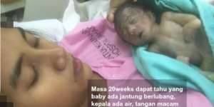 Bayi Sulit Dilahirkan, Setelah Bertemu Ustaz Ternyata...