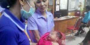 Ditikam 14 Kali, Dikubur Hidup-hidup, Bayi Ini Tetap Bertahan