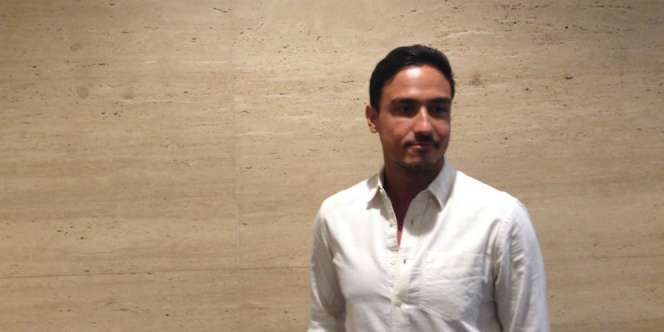 Hamish Daud Pernah Koma 3 Hari, Wajah Penuh Baut