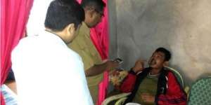 Gemar Cabut Bulu, Hidung dan Mulut Pria Ini Membusuk