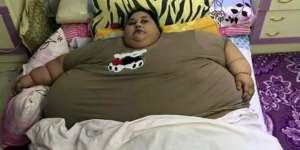 Wanita Seberat 500 Kg, Tak Bisa Gerak Selama 25 Tahun