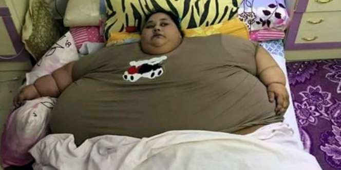 Wanita Seberat 500 Kg, Tak Bisa Gerak Selama 25 Tahun