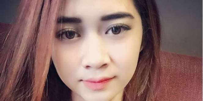 Mahasiswi Cantik Disiram Air Keras di Bandung