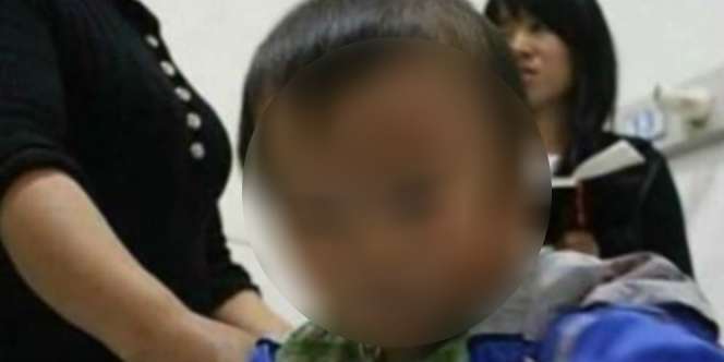 Curhatan Pilu Ibu Punya Anak Sumbing Wajah