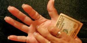 Rahasia Telapak Tangan Gatal Dapat Uang? Ternyata...