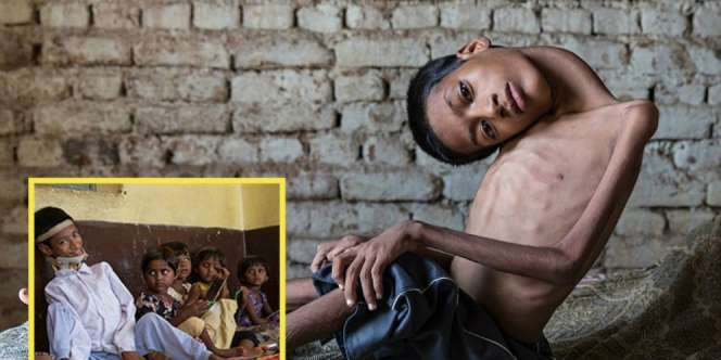 Innalillahi, Remaja yang Kepalanya Menggantung Meninggal