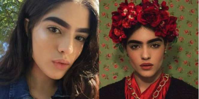 Diejek Alis Tebal, Kini Gadis Itu Jadi Model Terkenal