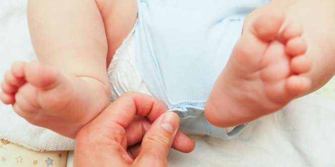 Waspada Jika Urine Bayi Lebih Berbau dari Biasanya
