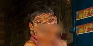 Nasib Menyedihkan si 'Anak Hantu', Bikin Nangis!