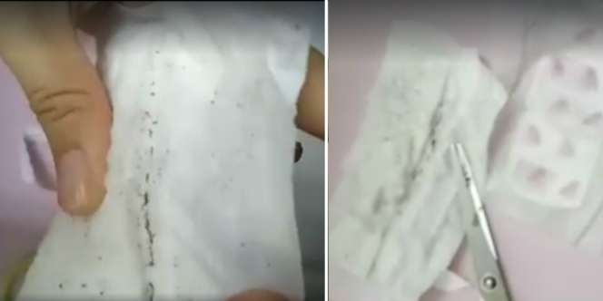 Pantas Gatal Tak Tertahan, Astaga Cek Pembalut Isinya...