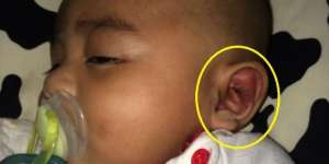Pengasuh Bilang Digigit Semut, Astaga Telinga Si Anak Ternyata