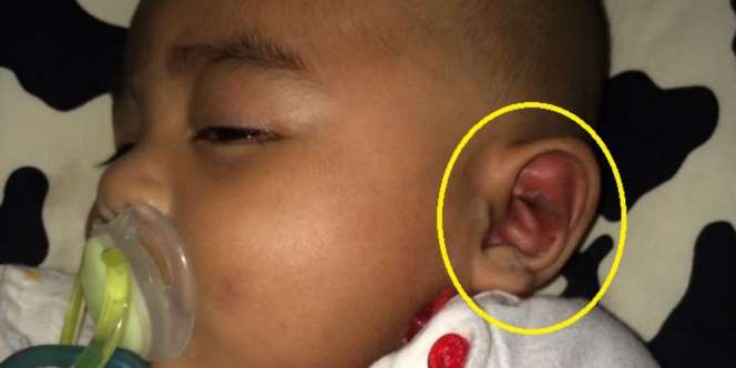 Pengasuh Bilang Digigit Semut, Astaga Telinga Si Anak Ternyata