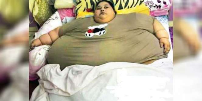 Kisah Pilu Perempuan Berbobot Setengah Ton