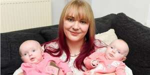 Dioperasi dalam Kandungan, Masyaallah Janin Kembar Lahir Sehat