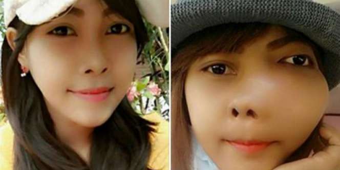 Cewek ini Dikira Edit Wajah Buat Cari Simpati, Ternyata...