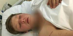 Ngeri! Bahaya Kalungkan Kabel Earphone Saat Kendarai Motor