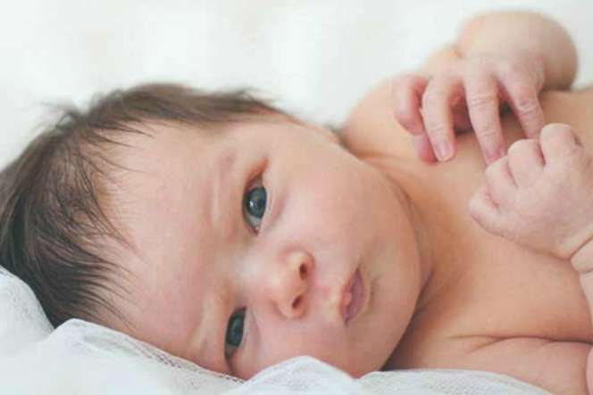 Ruam di Kulit Bayi Tak Kunjung Hilang, Ketahui Pemicunya