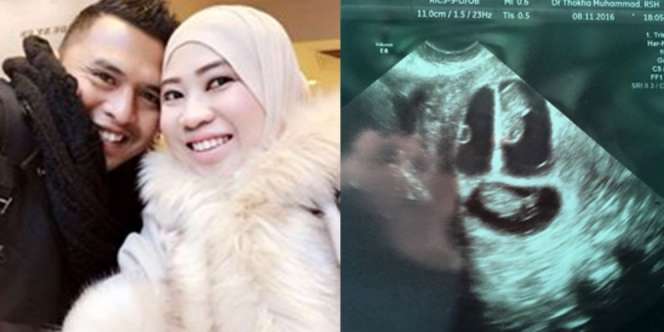 Alhamdulillah, Berkah Anak Angkat, Sekali Hamil Dapat...