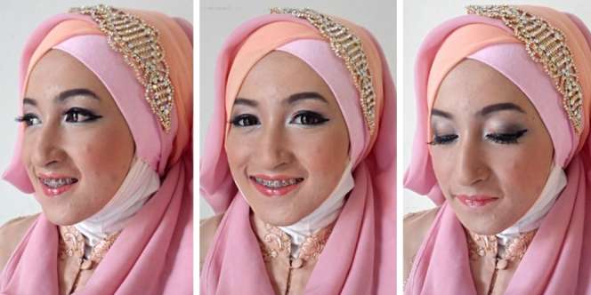 Dream Choice: Bye-bye Jerawat Bandel
