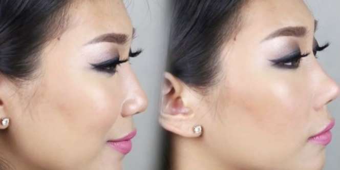 Alat Pemancung Hidung `Murah-Meriah` Ini Efektif, Tapi....