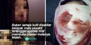 Pengalaman Dokter Rawat Pasien Pengguna Kosmetik Bermerkuri