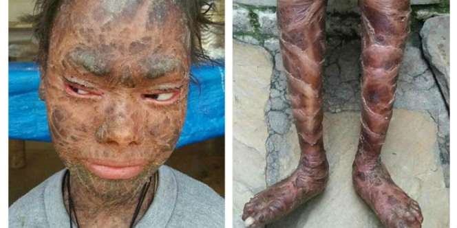 Cerita Nasib Malang Si Gadis Ular