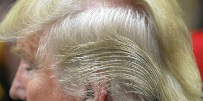 Dokter Pribadi Ungkap Misteri di Balik Rambut Donald Trump