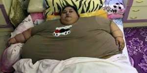 Masih Ingat Wanita Berbobot 500 Kg Ini? Nasibnya Kini...
