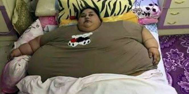 Masih Ingat Wanita Berbobot 500 Kg Ini? Nasibnya Kini...
