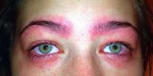 Gadis Remaja Nyaris Buta Gara-gara Pensil Alis