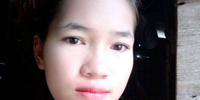 Gara-gara Hal Kecil, Wajah Gadis Cantik Berubah Mengerikan