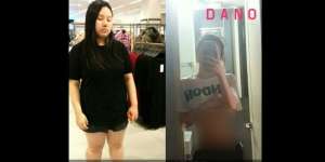 Ajaib! Gadis Ini Turunkan Bobot 50 Kg Hanya dengan Air Putih