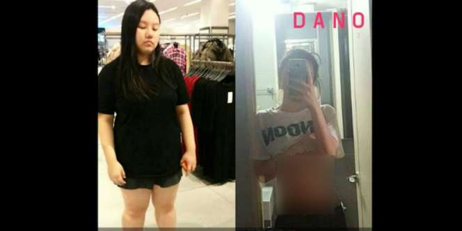 Ajaib! Gadis Ini Turunkan Bobot 50 Kg Hanya dengan Air Putih