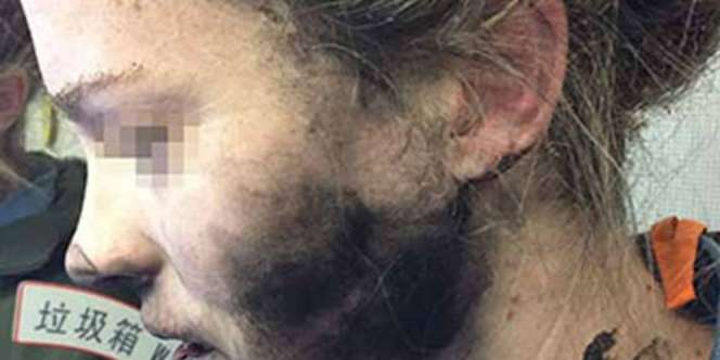 Wajah Perempuan Ini Terbakar Saat Mendengarkan Musik