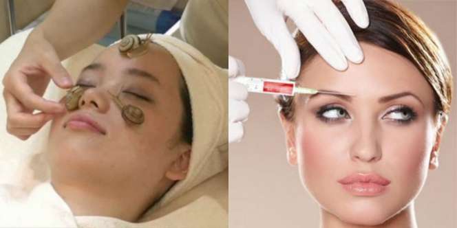 10 Treatment Kecantikan Paling Ekstrem di Dunia