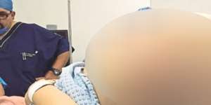 11 Bulan Si Wanita Seperti Hamil 10 Bayi, Setelah Dicek...