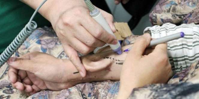 Akhirnya, Telinga di Tangan Terpasang di Kepala