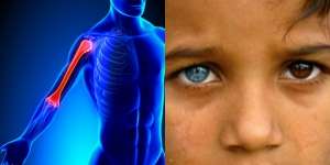 10 'Kemampuan Langka' Tubuh yang Cuma Dimiliki 5% Manusia