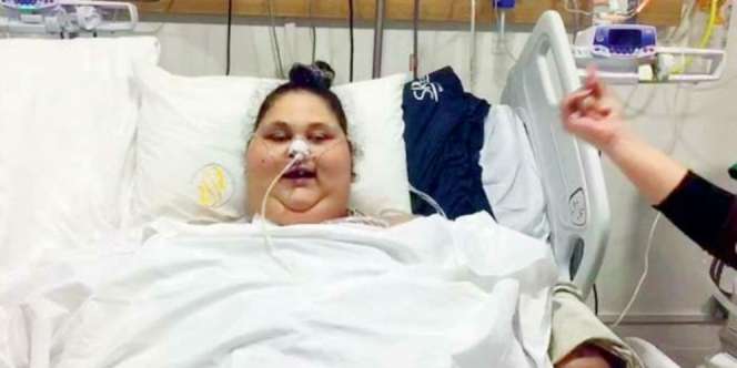 Setelah Operasi, Perempuan Berbobot 500 Kilogram Itu Kini...