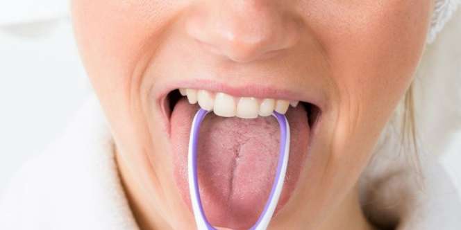 Ini yang Terjadi Saat Kotoran Lidah Tak Pernah Dibersihkan