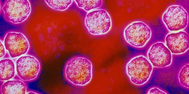 Kenali Gejala Campak, Jangan Sampai Telat