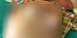 Disangka Hamil 'Anak Jin', Astaga Usai Diperiksa Dokter